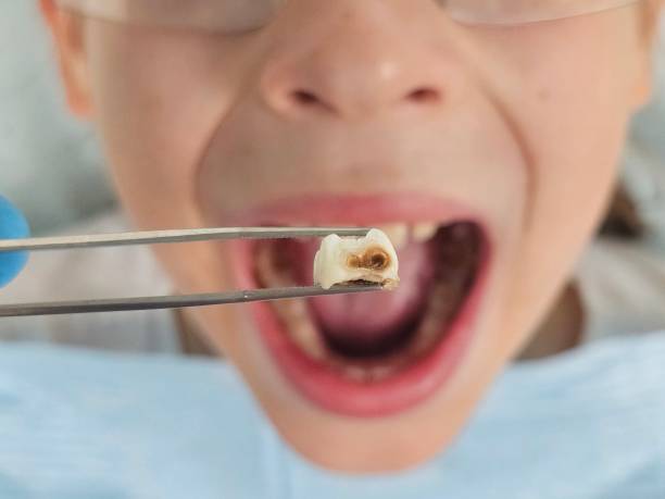 Best Emergency Pediatric Dental Care in Methuen Town, MA